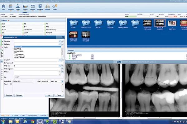 Skaermbillede af DentalSuite journalsystem